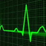 vibration monitoring