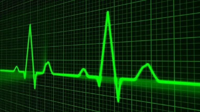 Vibration Analysis: All You Need to Know