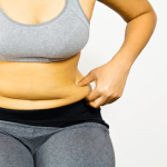 liposuction in Punjab