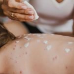 skin allergy treatment