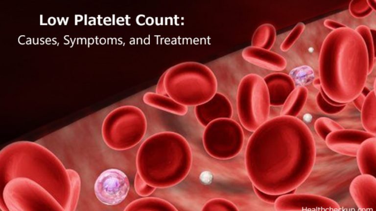 Thrombocytopenia (Low Platelet Count) : Causes, Symptoms & Treatment