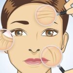 Dermatologist in Delhi
